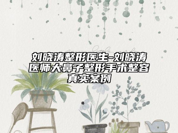 刘晓涛整形医生-刘晓涛医师大鼻子整形手术整容真实案例