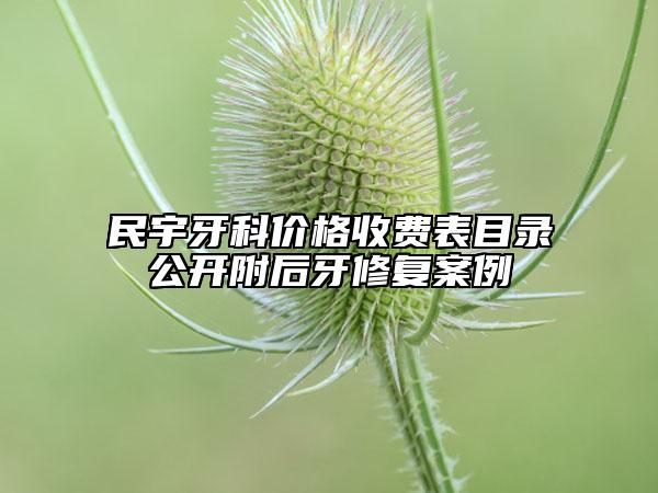 民宇牙科价格收费表目录公开附后牙修复案例