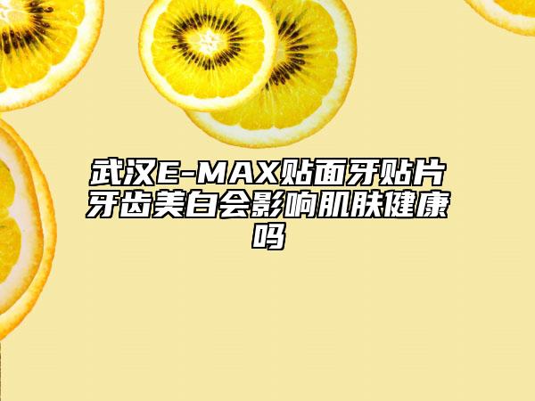 武汉E-MAX贴面牙贴片牙齿美白会影响肌肤健康吗