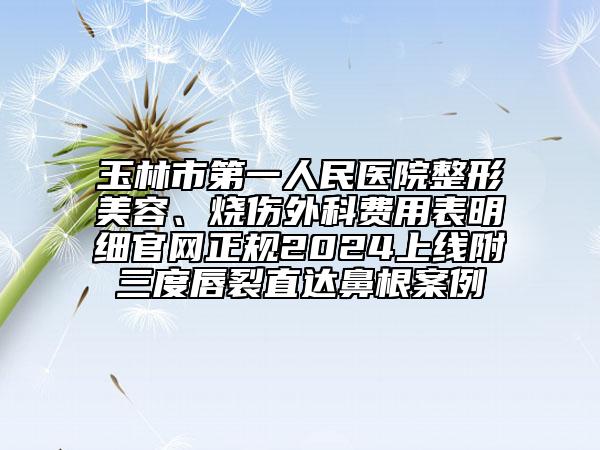 玉林市第一人民医院整形美容、烧伤外科费用表明细官网正规2024上线附三度唇裂直达鼻根案例