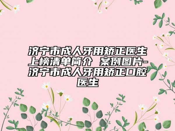 济宁市成人牙用矫正医生上榜清单简介 案例图片-济宁市成人牙用矫正口腔医生