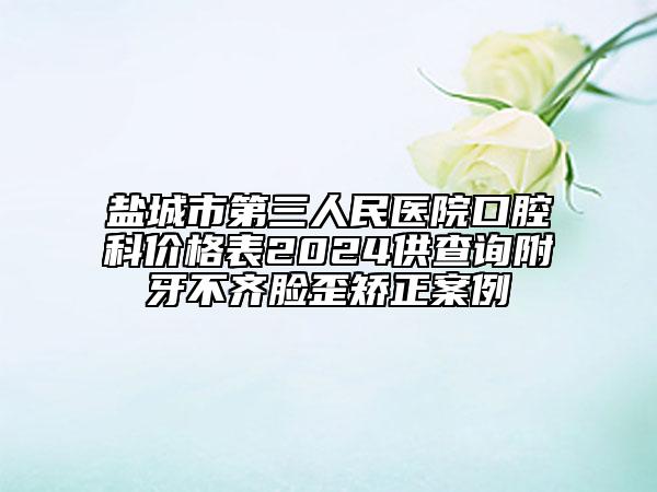 盐城市第三人民医院口腔科价格表2024供查询附牙不齐脸歪矫正案例