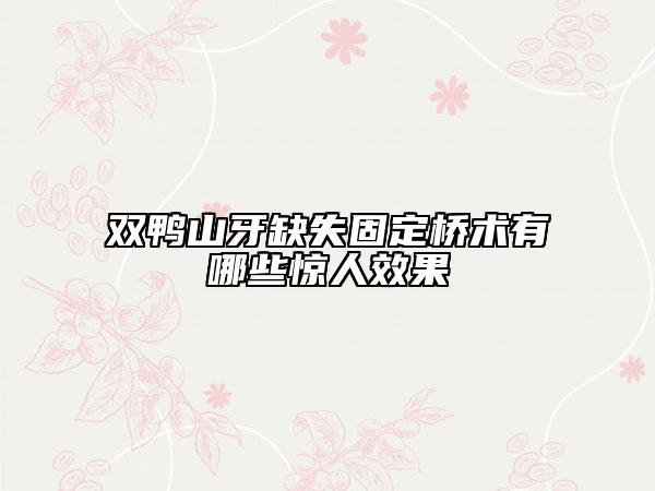 双鸭山牙缺失固定桥术有哪些惊人效果